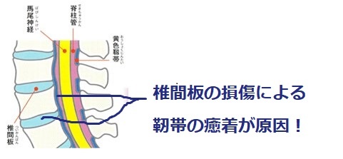 痛い
